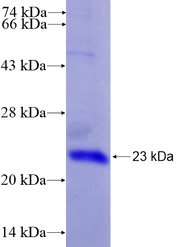 Recombinant Human TLR1 SDS-PAGE