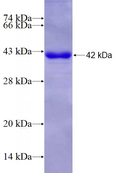 Recombinant Human DDX4,VASA SDS-PAGE