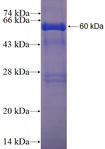 Recombinant Human PRKRA SDS-PAGE