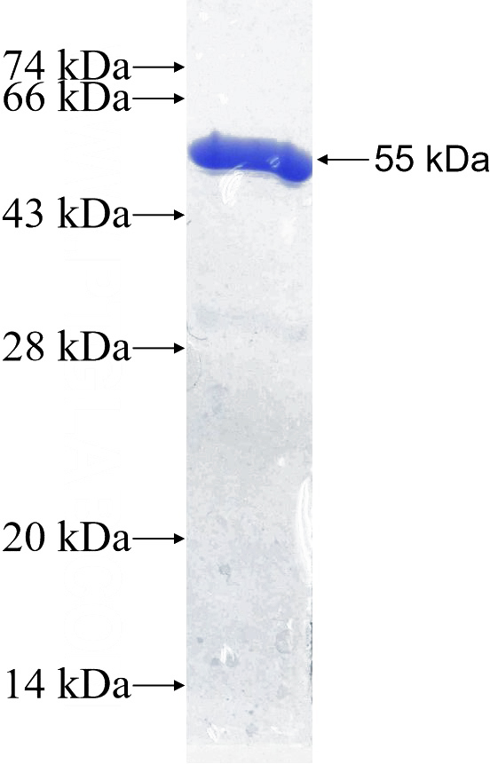 Recombinant Human SNAP29 SDS-PAGE