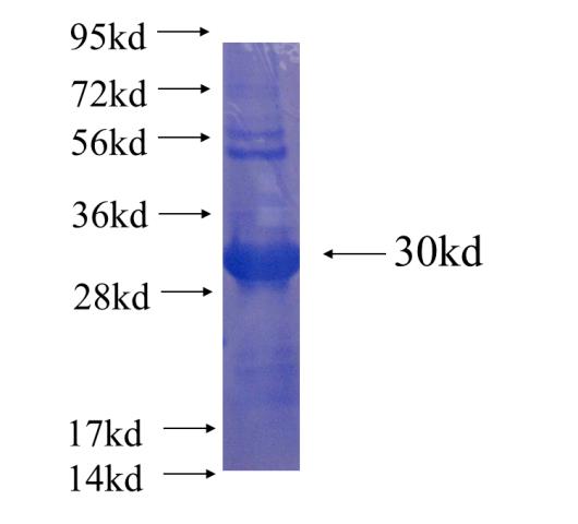 Recombinant human LRRC52 SDS-PAGE