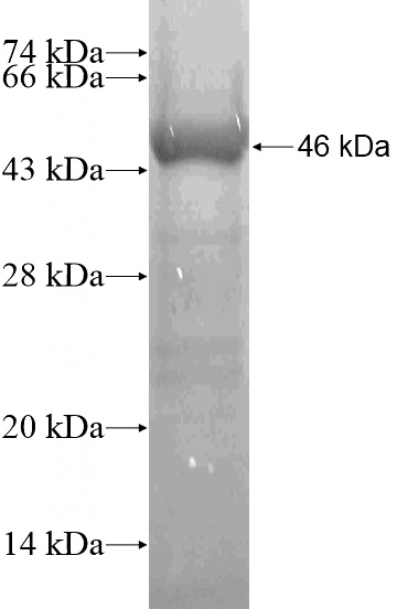 Recombinant Human MLYCD SDS-PAGE