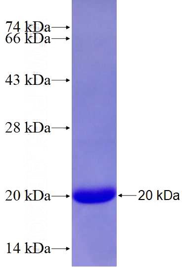 Recombinant Human LIMD1 SDS-PAGE