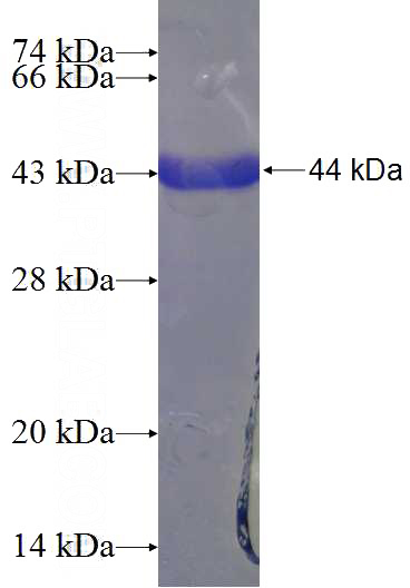 Recombinant Human SMARCAL1 SDS-PAGE