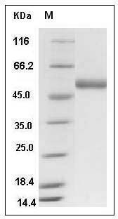 Human ENTPD3 / NTPDase3 / CD39L3 Protein (His Tag) SDS-PAGE