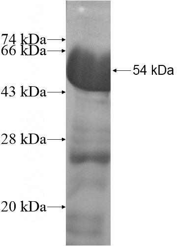 Recombinant Human THAP4 SDS-PAGE