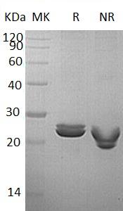 Human LYG2/LYGH (His tag) recombinant protein