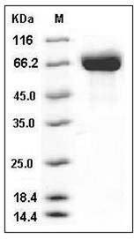Mouse BCHE / Butyrylcholinesterase Protein (His Tag) SDS-PAGE