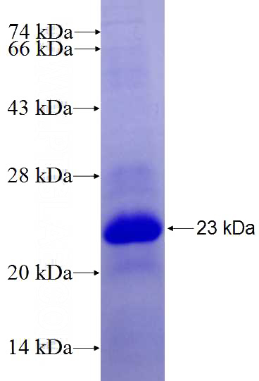 Recombinant Human KLHL24 SDS-PAGE