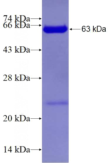 Recombinant Human TBC1D22A SDS-PAGE