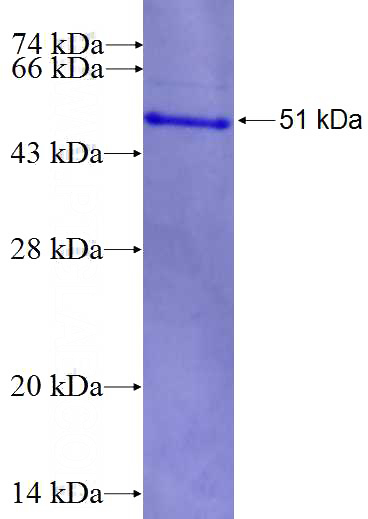 Recombinant Human AOC2 SDS-PAGE