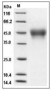 Human CD16a / FCGR3A Protein (176 Val, His Tag) SDS-PAGE