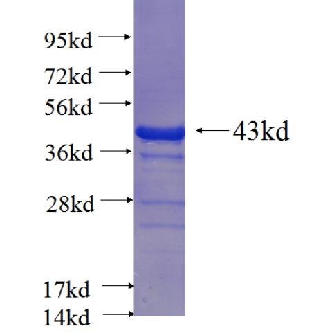 Recombinant human SPA17 SDS-PAGE