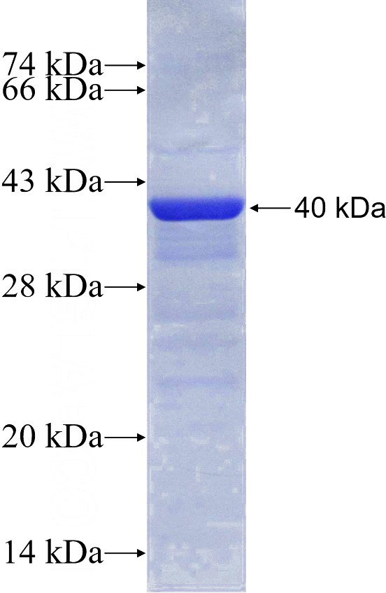 Recombinant Human CDC2L1 SDS-PAGE