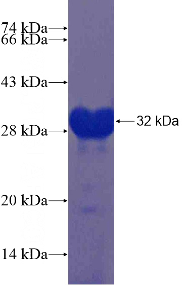 Recombinant Human BARHL2 SDS-PAGE