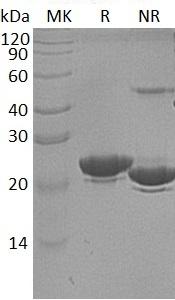 Human LCN2/HNL/NGAL (His tag) recombinant protein
