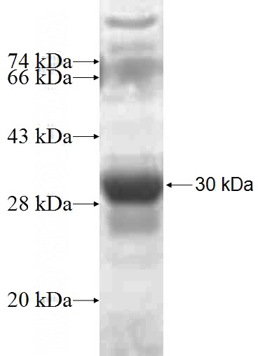 Recombinant Human MTMR6 SDS-PAGE