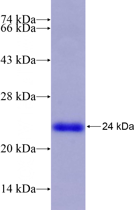 Recombinant Human WNT10B SDS-PAGE