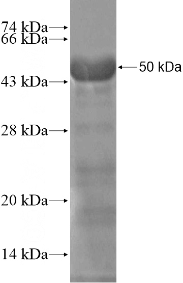 Recombinant Human MYT1L SDS-PAGE