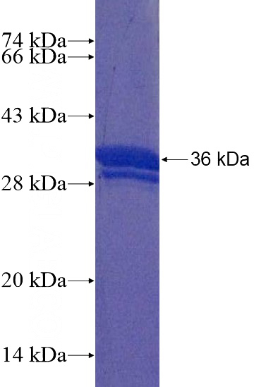 Recombinant Human SCML2 SDS-PAGE