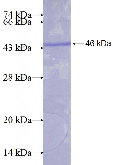 Recombinant Human AURKB SDS-PAGE