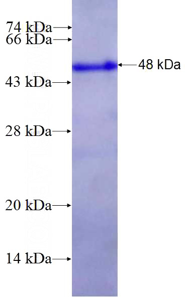 Recombinant Human NOC2L SDS-PAGE