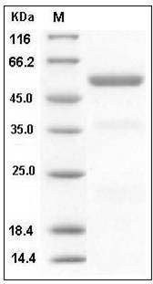 Human Carboxypeptidase E / CPE Protein (His Tag) SDS-PAGE
