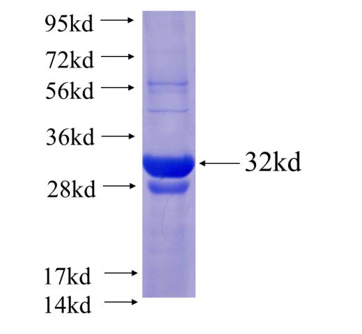 Recombinant human CAPZB SDS-PAGE