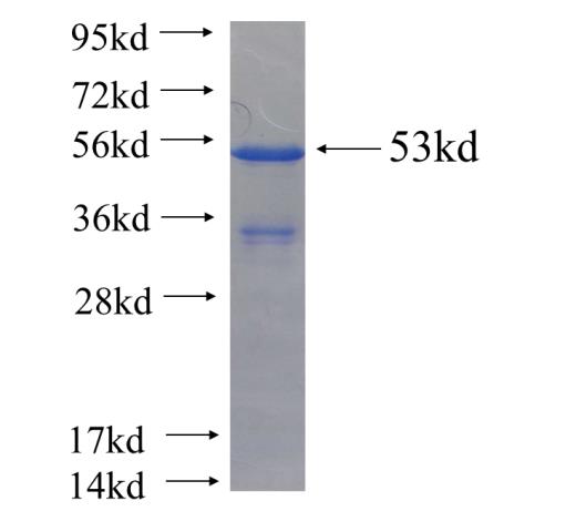 Recombinant human MMADHC SDS-PAGE