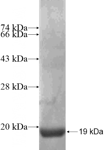 Recombinant Human ANO10 SDS-PAGE