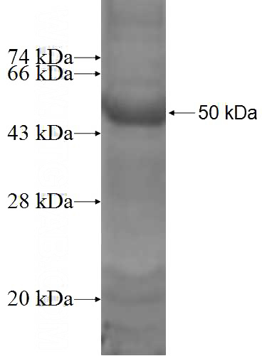 Recombinant Human ESX1 SDS-PAGE
