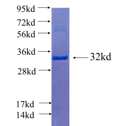 Recombinant human STX5 SDS-PAGE