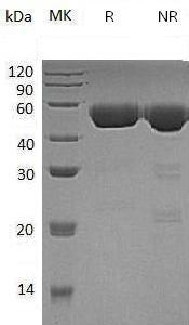 Human CTSD/CPSD (His tag) recombinant protein