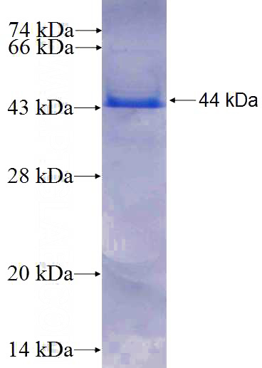 Recombinant Human NOMO2 SDS-PAGE