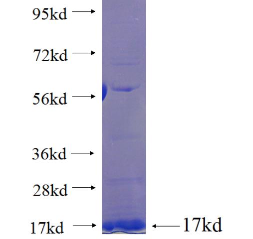 Recombinant human SLC6A20 SDS-PAGE