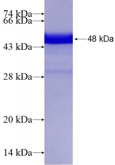 Recombinant Human SAMD9L SDS-PAGE