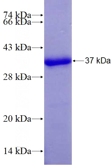 Recombinant Human PMS1 SDS-PAGE