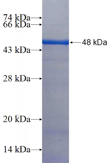 Recombinant Human HLA-DRA SDS-PAGE