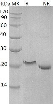 Human TNFRSF1A/TNFAR/TNFR1 (His tag) recombinant protein