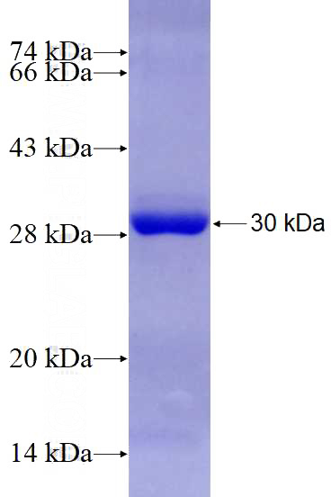 Recombinant Human FANCI SDS-PAGE
