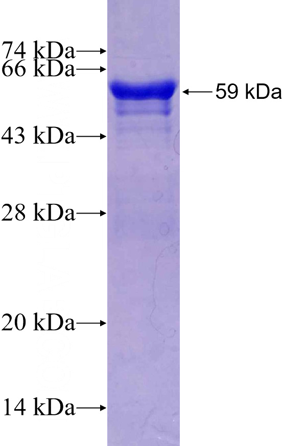 Recombinant Human RP1-21O18.1 SDS-PAGE