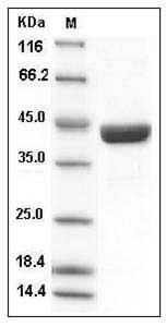 Human SerpinB9 / CAP-3 Protein (His Tag) SDS-PAGE