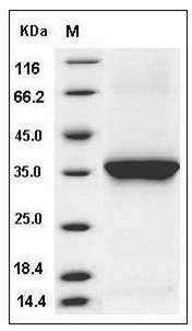 Rat IL-1 beta / IL1B Protein (pro form, His Tag) SDS-PAGE