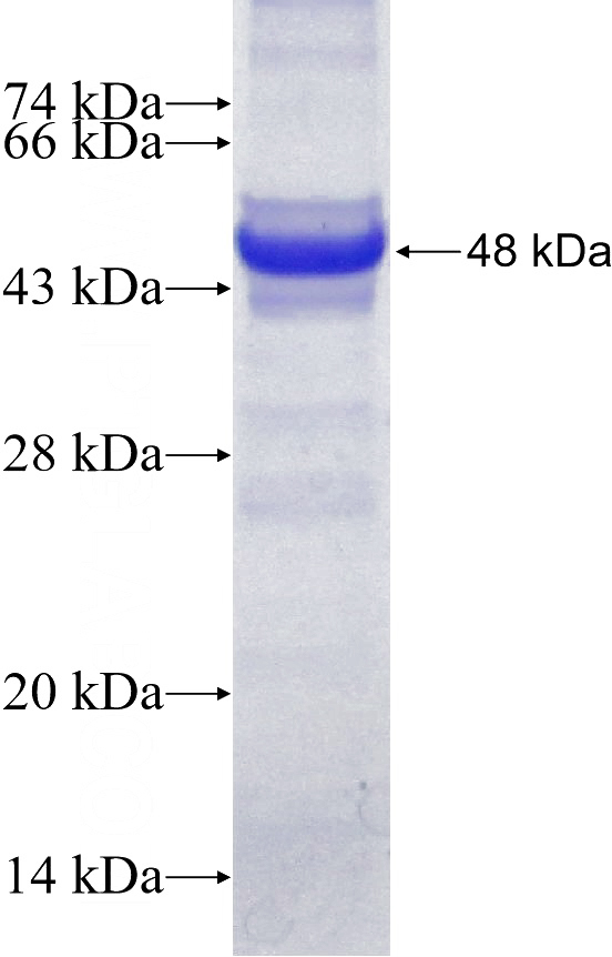 Recombinant Human DDX24 SDS-PAGE
