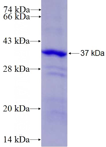 Recombinant Human CSNK1D SDS-PAGE