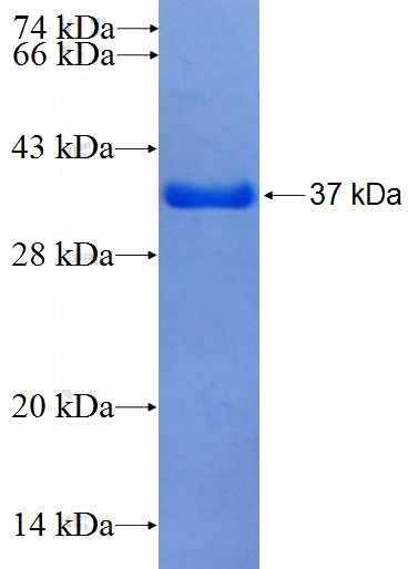 Recombinant Human FCRLA SDS-PAGE