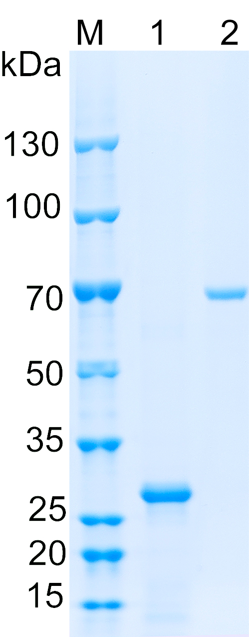 Recombinant Human JTV1 SDS-PAGE