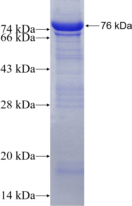 Human tubulin-Alpha Recombinant protein (GST tag)