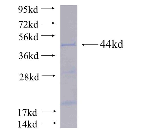 Recombinant human ACSS1 SDS-PAGE