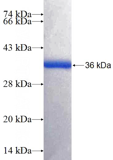 Recombinant Human NEK1 SDS-PAGE